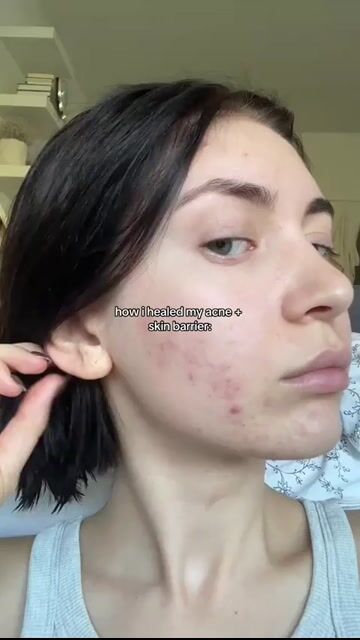 Video de SkinFree