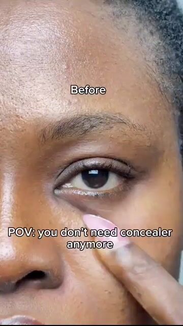 Video de SkinFree