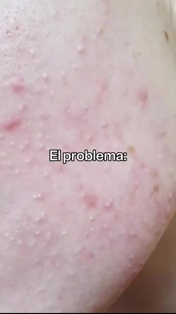Video de Manglara
