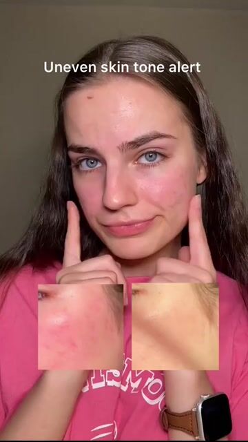 Video de SkinFree