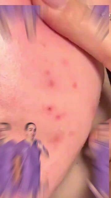 Video de Manglara