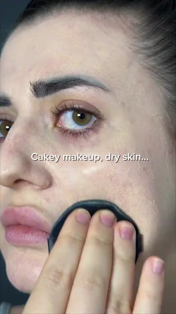 Video de SkinFree