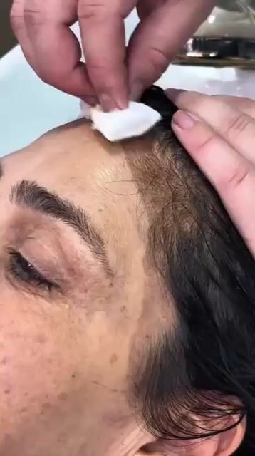Vídeo de Removedor de Tinta de Cabelo para Pele