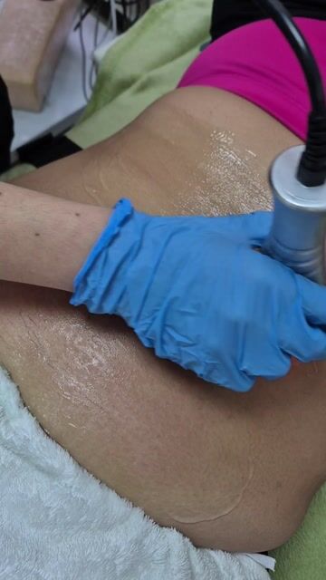 Video de Pack Radiofrecuencia Corporal
